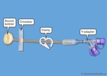 Y-adaptor, crossbar and round bolster on a T-bar/crossbar fixation device