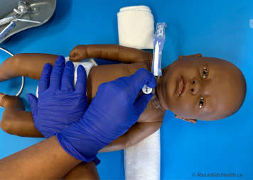 One hand holding the new tracheostomy tube with the obturator being held in place as it is being inserted