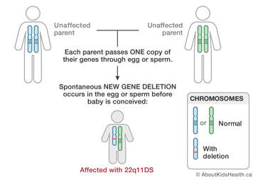 Chromosome distribution from unaffected parents resulting in spontaneous new gene deletion before baby is conceived