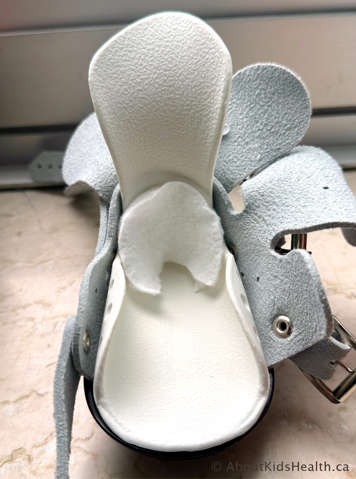 Placing a cotton pad on an unaffected side to help prevent a pressure sore