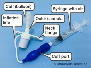 Parts of a cuffed tracheostomy tube