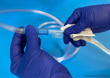 Attaching suction tubing to a tracheostomy suction catheter