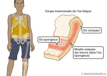 Coupe transversal de l’os iliaque montrant l’os compact, l’os spongieux et la moelle osseuse (se trouve dans l’os spongieux)