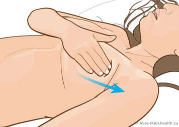 Massaging of the breast, pushing towards the arm pit