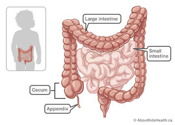 Location of cecum in the large intestine