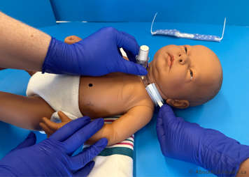 Caregivers detaching tracheostomy tube ties on child