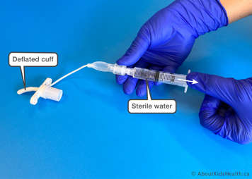 plunger being pulled back to draw all the water and air from the cuff into the syringe