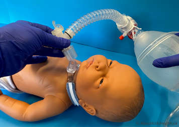 Resuscitation bag being connected to the tracheostomy tube