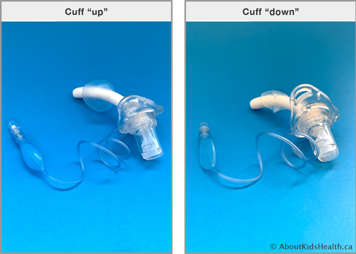 Cuff up (inflated) vs cuff down (deflated)