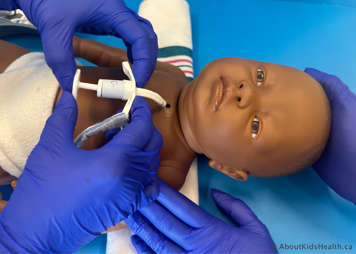 New tracheostomy tube being held in position before it is inserted