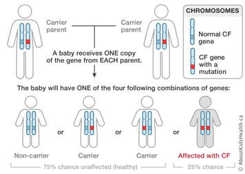 Chromosome distribution from parents carrying cystic fibrosis