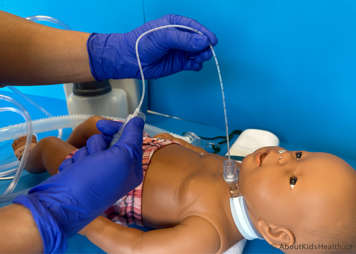 Most of the suction catheter has been removed from the tracheostomy tube