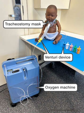 A Venturi device showing the oxygen machine, mask, and multi-colored connectors