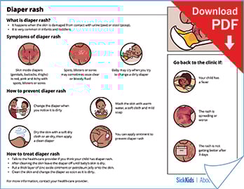 Clickable thumbnail of the diaper rash at a glance handout