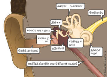 செவிப்பறை மென்சவ்வு மற்றும் செவிக் கால்வாய் செந்நிறமாகவும் அரிப்புணர்வுடனும் இருத்தல்; கால்வாய் சுவர் வீங்கி இருத்தல்; மற்றும் சிதல் வெளியேற்றம்