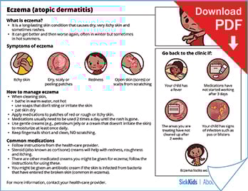 Clickable thumbnail of the eczema or atopic dermatitis at a glance handout