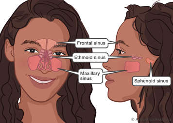 Frontal sinus in forehead, ethmoid sinus between eyes, maxillary sinus in cheeks beside nose, sphenoid sinus near ear