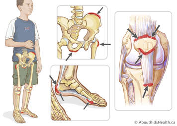 Entheses in the lower half of the body