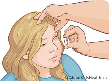 Demonstration of how to hold artificial eye between thumb and first finger while holding upper eyelid open with other hand