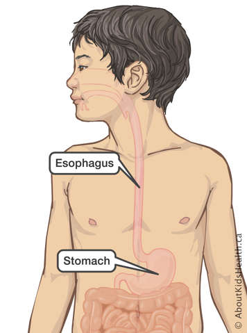 Upper body of a boy with esophagus and stomach identified