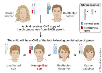 Distribution of X and Y chromosomes from carrier mother and unaffected father, producing four possible results