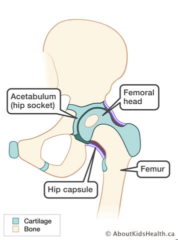 hipjoint anatomy in infant showing the acetabulum or hip socket, the femoral head, the femur, and the hip capsule