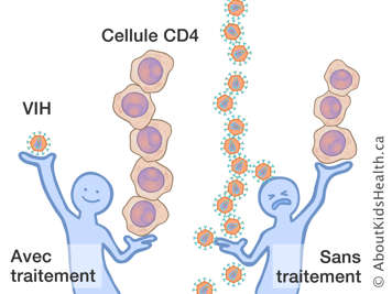 Individu avec traitement tenant un VIH et plusieurs CD4 et individu sans traitement tenant peu de CD4 et plusieurs VIH