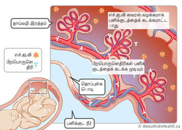 HIV பிறபொருளெதிரிகள் பனிக்குடத்தைக் கடக்கும்