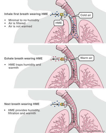 How an HME works showing how humidity and warmth is trapped