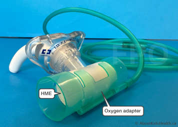 Oxygen adapter attached to the top of an HME