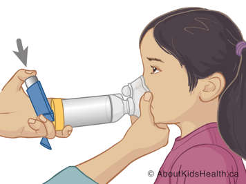 Holding mask over child&rsquo;s nose and mouth with one hand and pushing down on inhaler with the other