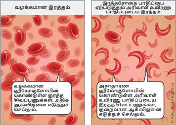 Red blood cells with normal hemoglobin carry enough oxygen&mdash;sickled red blood cells with abnormal hemoglobin carry less oxygen