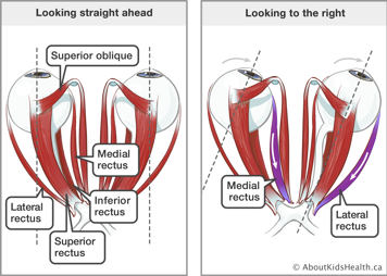 The superior oblique, medial rectus, inferior rectus, superior rectus, and lateral rectus muscles in the eyes