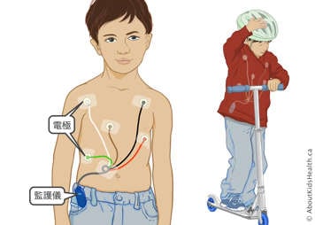 佩帶監測器的孩子正在玩滑行車，監測器的電極貼在皮膚上