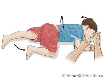 Putting child in recovery position