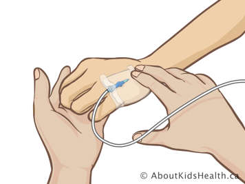 Feeling hand for temperature change or leakage at IV site