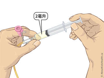 图示：一人手持装有约2毫升胃内容物的注射器