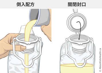 將配方奶倒入餵奶袋中，並封好餵奶袋的封口