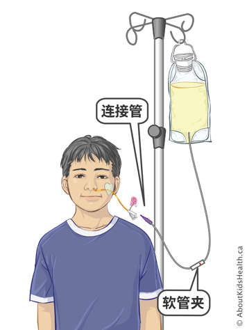 Connect tubes and roller clamp on infusion tubing for attaching a feeding bag to a child&rsquo;s NG tube
