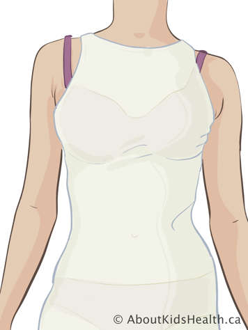 Woman wearing stockinette undershirt over bra and underpants