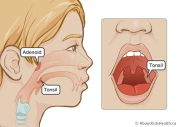 Location of tonsils and adenoids