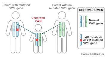 Chromosomes in a parent with mutated VWF gene, in a parent with no mutated VWF gene, and in a child with VWD