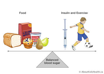 A balanced scale with food on one side and a depiction of insulin and exercise on the other