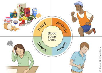 Illustration of factors affecting blood sugar levels