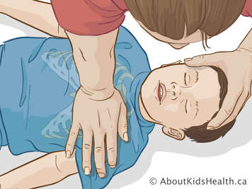 Performing chest compressions on older child