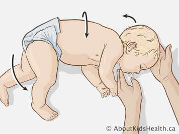 Placing baby in recovery position