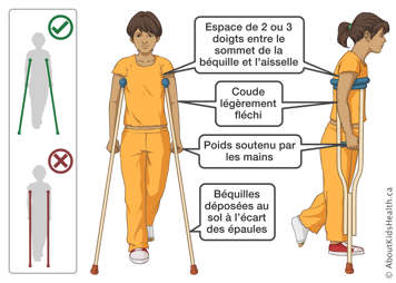 Utilisation correcte des béquilles