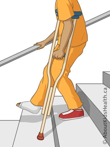 Using one crutch and a handrail to descend stairs