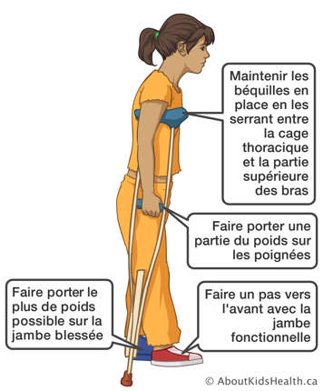 Prenant un pas avec la jambe fonctionnelle en portant le plus de poids possible sur la jambe blessée à l’aide des béquilles