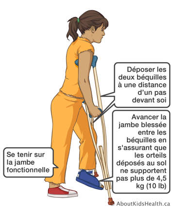 Utilisant les béquilles pour s’assurer que les orteils de la jambe blessée ne supportent pas plus de dix poids en marchant